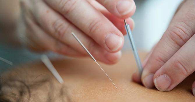 Other Conditions Acupuncture Treats